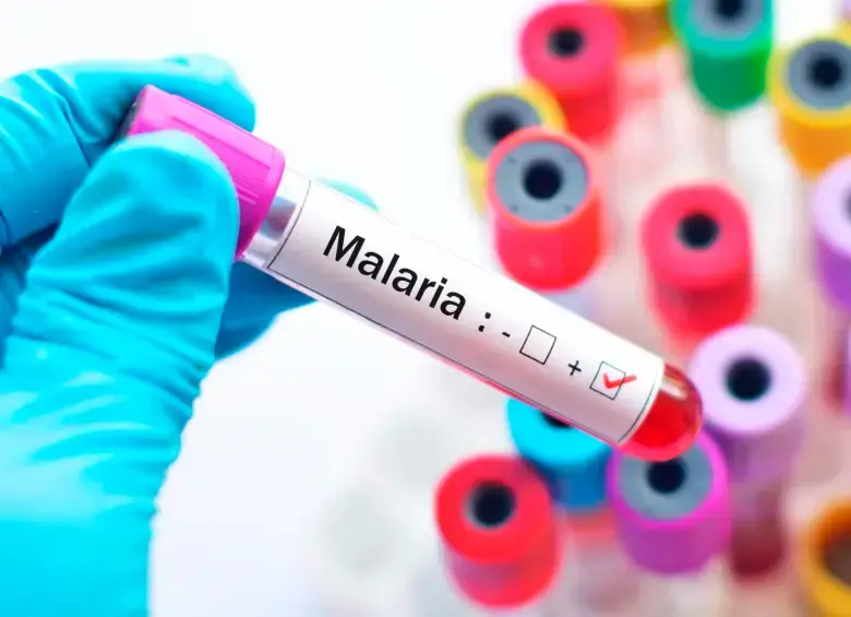La malaria es una enfermedad tropical transmitida principalmente por la picadura de un mosquito. FOTO SSTOCK