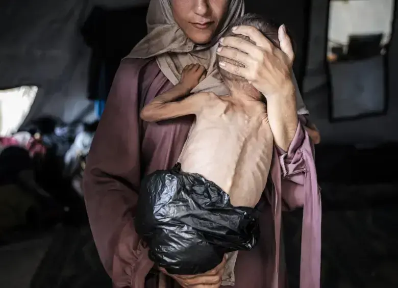 El hambre usada como arma de guerra. FOTO: GETTY