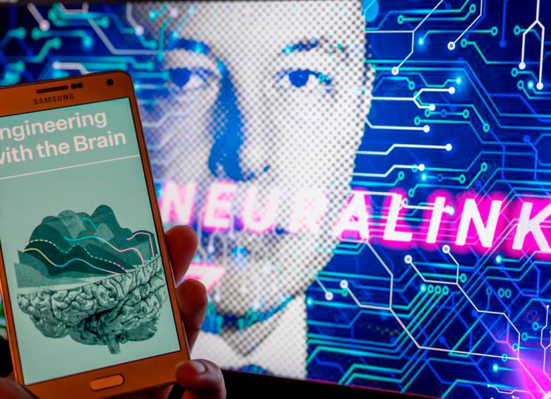 La empresa Neurolink, propiedad de Elon Musk, entregó los primeros resultados del implante puesto hace un mes en el cerebro de un humano. FOTO Getty. 