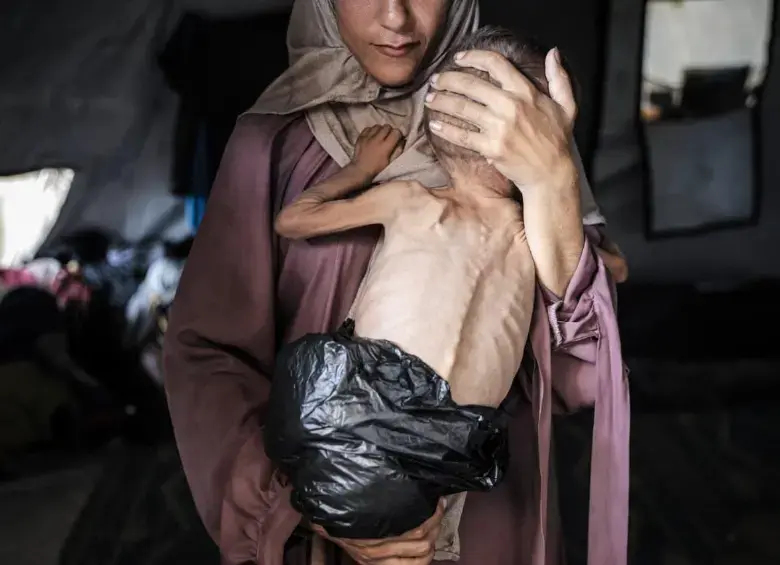 Esta es la foto de Hedaya al-Muta cargando en brazos a su hijo Mohamed Zakariya Ayyoub al-Matouq, de 1 año, en medio de la hambruna de Gaza. FOTO: Getty-Ahmed al-Arini