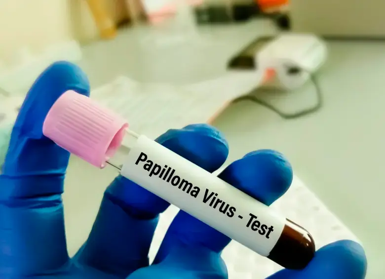 La mayoría de las personas que tienen el virus del papiloma humano no presentan síntomas. FOTO: OPS