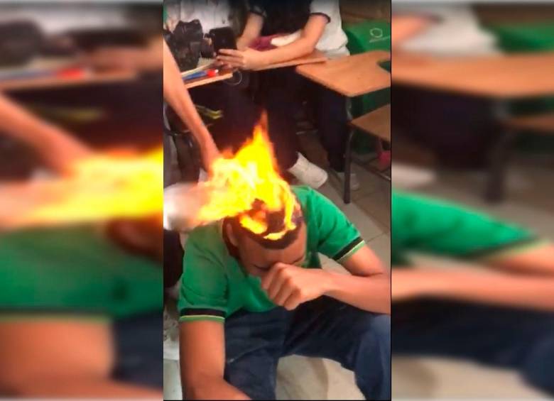 El estudiante al cual le incendiaron el pelo no sufrió lesiones. FOTO: CORTESÍA DENUNCIAS ANTIOQUIA