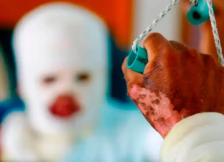 Dos de las personas resultaron con heridas de tercer grado, significa que muy seguramente quedarán con secuelas permanentes. FOTO: ARCHIVO EL COLOMBIANO