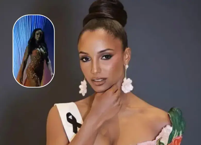Gabrielle Henry, Miss Jamaica, continúa en UCI tras una fuerte caída durante la ronda preliminar del Miss Universo 2025. FOTO: Tomada de Instagram @officialgabriellehenry