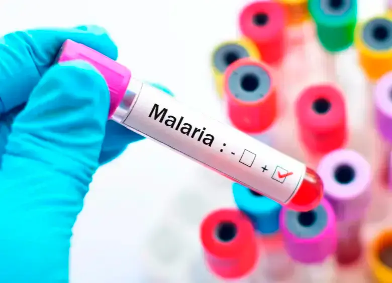 La malaria es una enfermedad tropical transmitida por un mosquito. FOTO SSTOCK