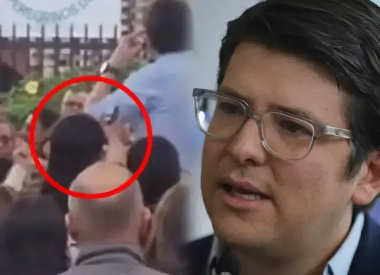 Fractura de cráneo con un disparo por la espalda de un sicario a plena vista. Foto: redes sociales | Colprensa