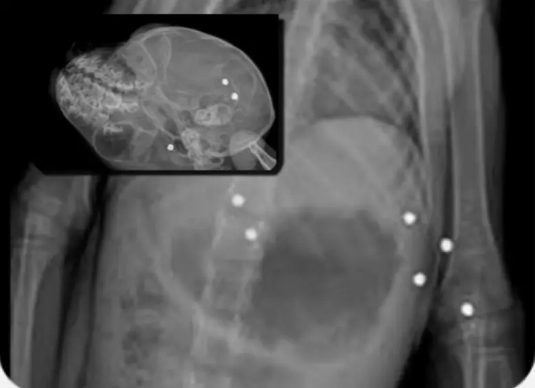 En el cuerpo del primate, habían 19 perdigones alojados en distintas partes de su cuerpo. FOTO: Corantioquia