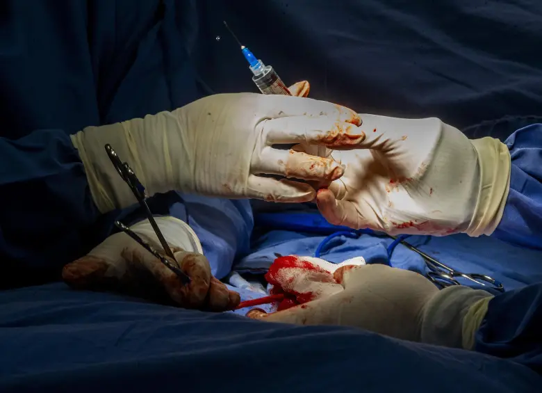 Imagen de referencia de una cirugía de transplante de órganos. FOTO: JULIO CÉSAR ECHEVERRI