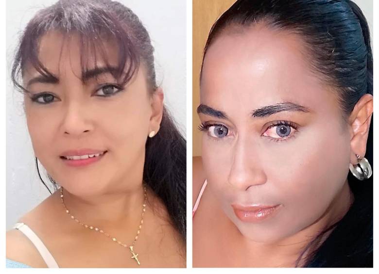 Darly Giovanna Arenas Suárez (izq.) y Danay Gisela Padilla Rodríguez (der.) fueron dos de las víctimas por los procedimentos estéticos en el Valle de Aburrá este año. FOTOS: CORTESÍA