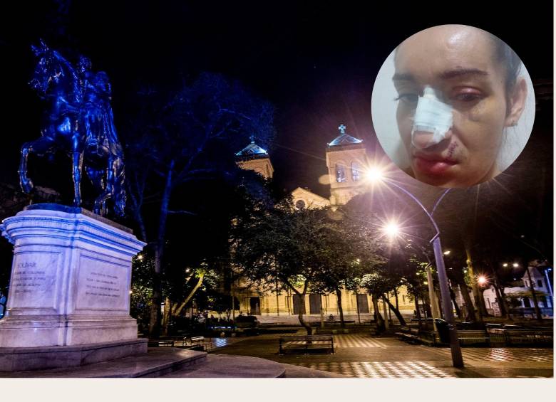 El episodio de violencia que vivió Danielis tuvo lugar en las inmediaciones del Parque Bolívar, centro de Medellín. Ella ya fue sometida a una cirugía de reconstrucción de nariz, una sutura en el labio. FOTOS Jaime Pérez y CORTESÍA
