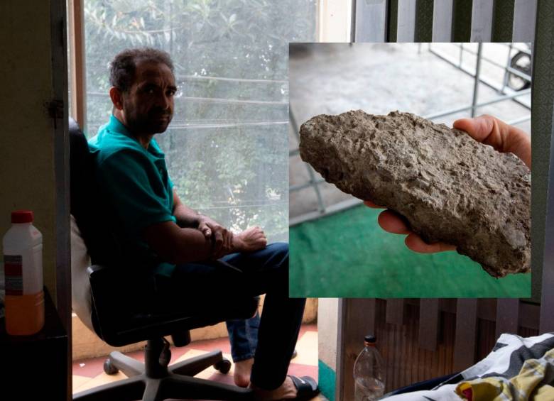 Luis Miguel Aguilar está bajo los cuidados de su familia luego de ser agredido con una piedra para robarle el celular. FOTOS: EDWIN BUSTAMANTE