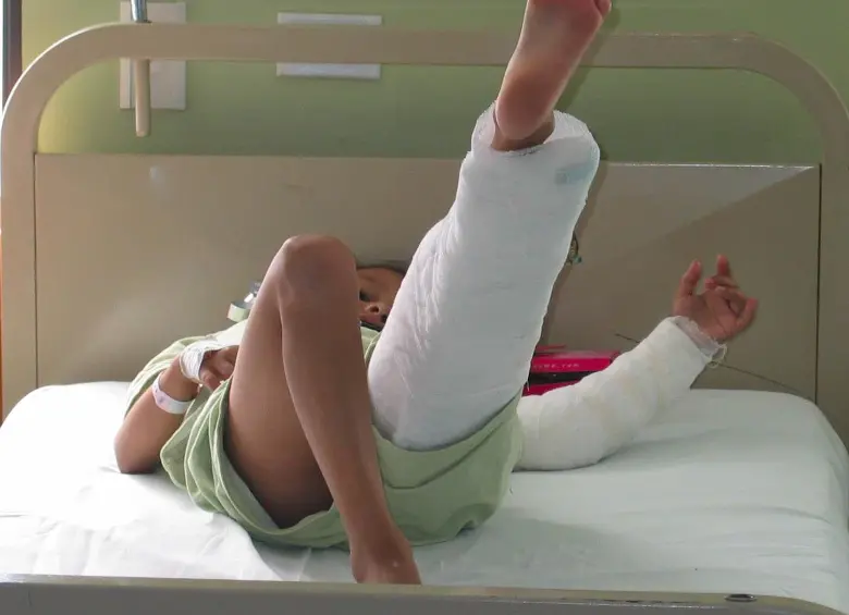 Imagen de referencia de un menor de edad quemado con pólvora. Foto: EL COLOMBIANO