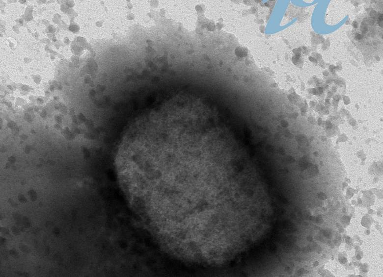 Virus de la viruela del mono ivisto por microscopía electrónica. FOTO: EFE