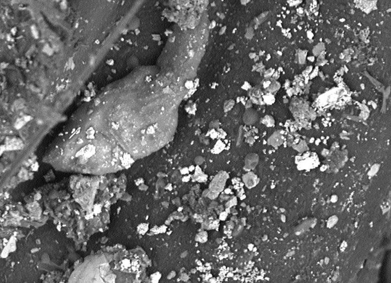 Así se ve en el microscopio: los puntos blancos es el material particulado acumulado en una planta. FOTO CORTESÍA José Duque