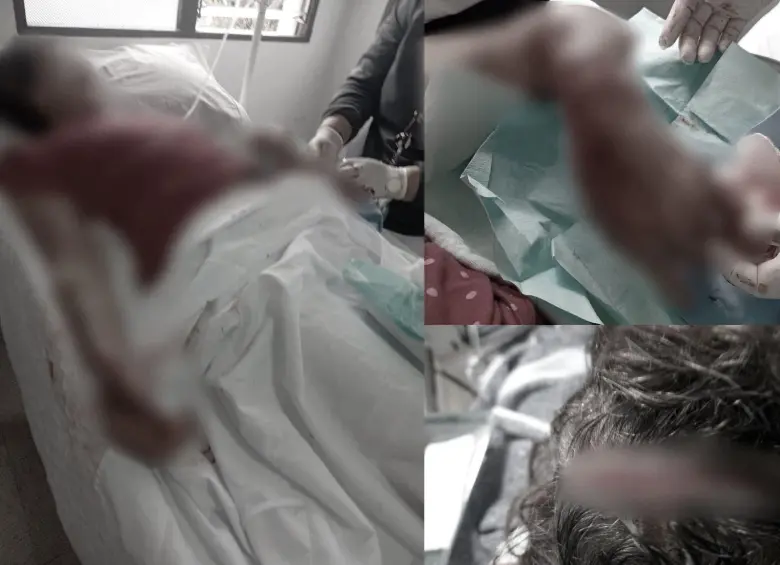 Doña Orfilia sufrió lesiones en el brazo izquierdo, con amputación de un dedo; así como mordeduras en la cabeza y en la cara. FOTOS: CORTESÍA
