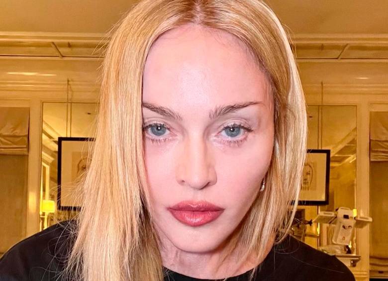 Esta fue la selfie que compartió la reina de pop en el post que habla de su recuperación. FOTO IG Madonna