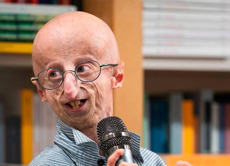 La esperanza de vida de una persona con progeria o síndrome de Hutchinson-Gilford es de unos 13 años. FOTO: Tomada de Instagram @francescogiulianoph