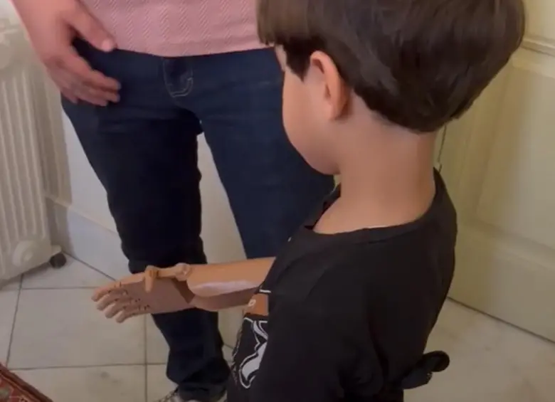 Niños en Gaza reciben prótesis impresas en 3D gracias a la ONG española Ayúdame3D, que trabaja con aliados locales para diseñarlas y enviarlas gratuitamente. FOTO cortesía AYÚDAME3D