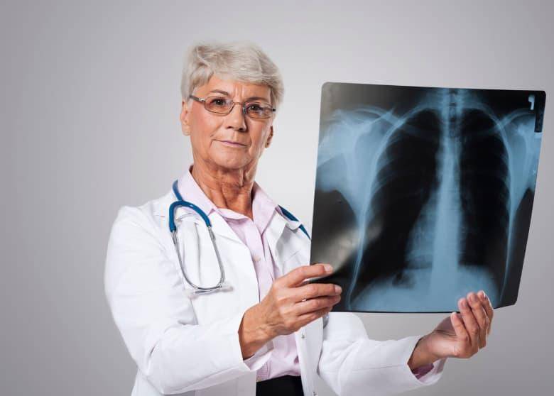 Entre el 50% y el 60% de los cánceres de pulmón diagnosticados en personas que nunca han fumado corresponden a adenocarcinomas. FOTO: Magnific. 