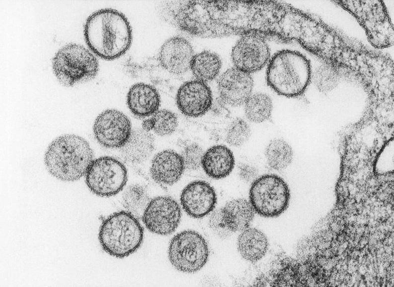Hantavirus visto a microscopía. FOTO agencia Sinc/CDC/Brian W.J. Mahy, PhD; Luanne H. Elliott, M.S.
