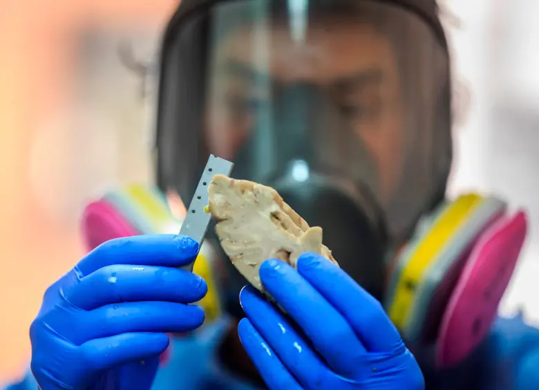 Cada año hay 10 millones de casos nuevos de demencia en todo el mundo. FOTO Camilo Suárez