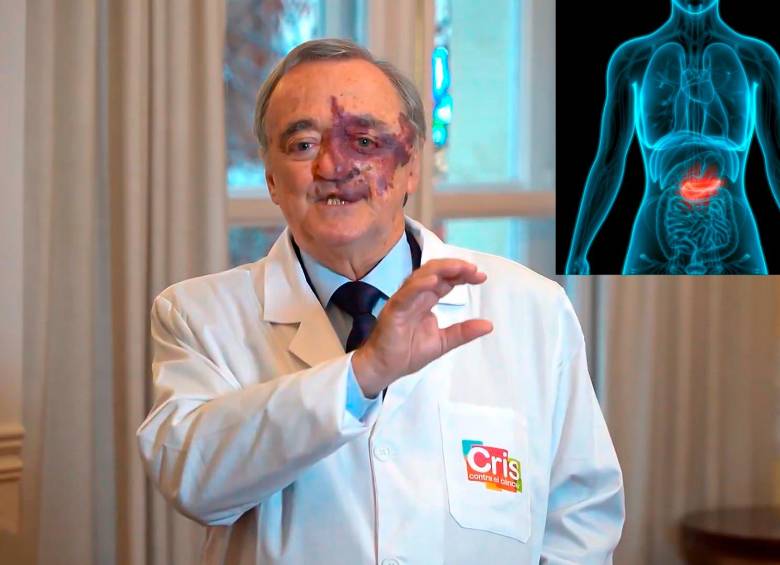 El estudio fue realizado por el Grupo de Oncología Experimental del Centro Nacional de Investigaciones Oncológicas (CNIO) de España. Foto captura de video y Depositphotos.