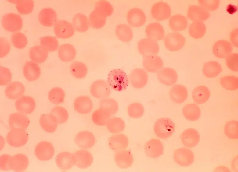 En Medellín diseñaron dispositivo para detectar infección de malaria en 30 segundos