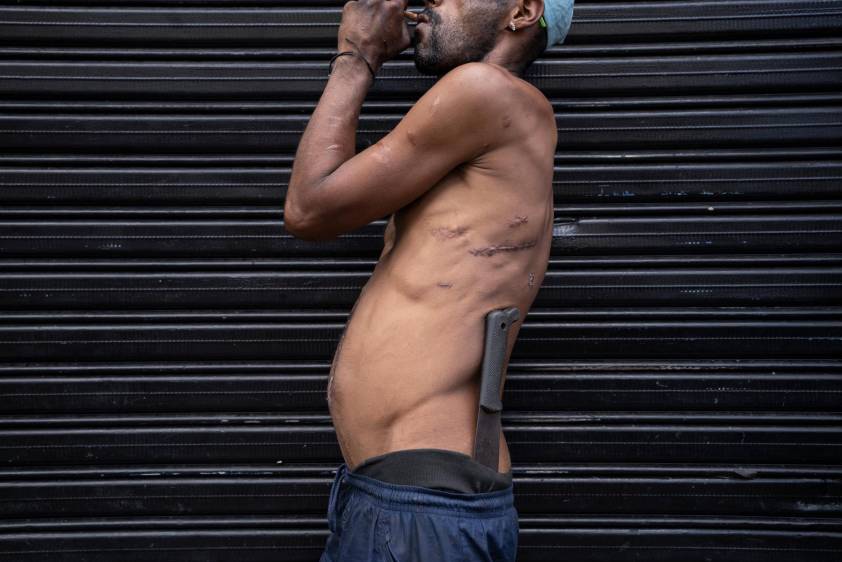 Frankenstein no es un monstruo de ciencia ficción, sino un hombre de la calle cosido a puñaladas y marcado por la vida en las calles del Bronx de Medellín. Ospina une las piezas rotas de la humanidad en esta imagen descarnada.