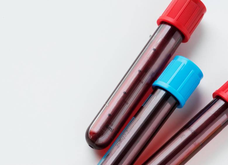 Se encontraron cuatro tipos de microplásticos en más de 17 personas. Imagen de referencia. Foto: Freepik