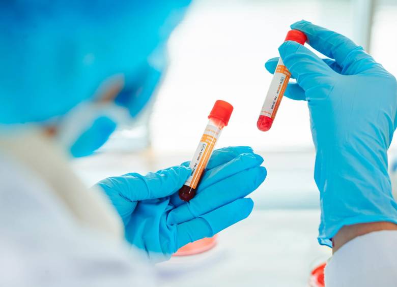 La detección del cáncer en sangre existe. La novedad de la prueba Galleri es que puede detectar hasta 50 tipos, algunos de ellos de difícil diagnóstico. FOTO SSTOCK.
