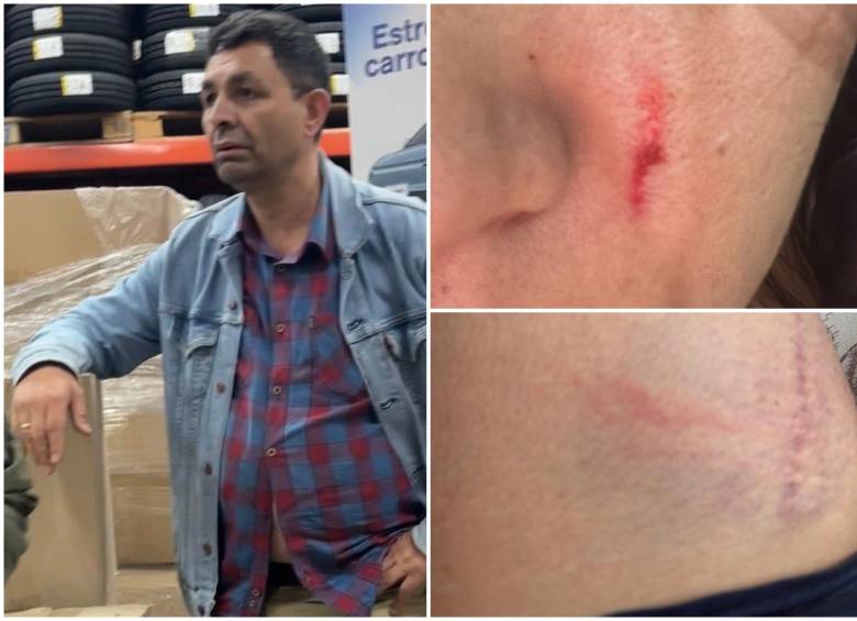 La denunciante mostró sus heridas e identificó al presunto agresor. FOTO: Tomada de redes sociales @Juanita_Bog