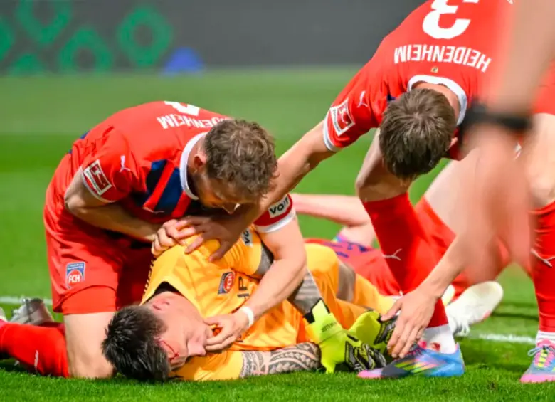El impacto fue tan fuerte que Kevin Müller quedó tendido en el césped, desatando nerviosismo en el campo. FOTO: AFP