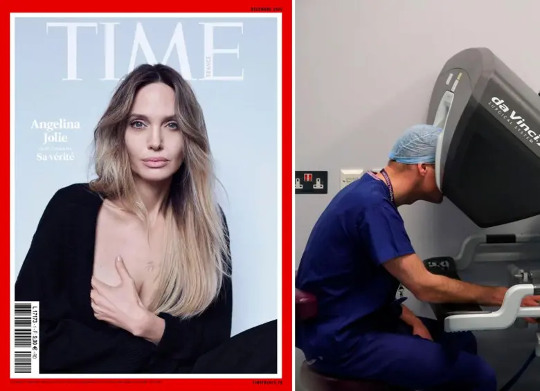 Izquierda: la portada de la revista Time France. Derecha: un médico en los escaneos previos a una mastectomia. Foto: Cortesía Time France y Getty.