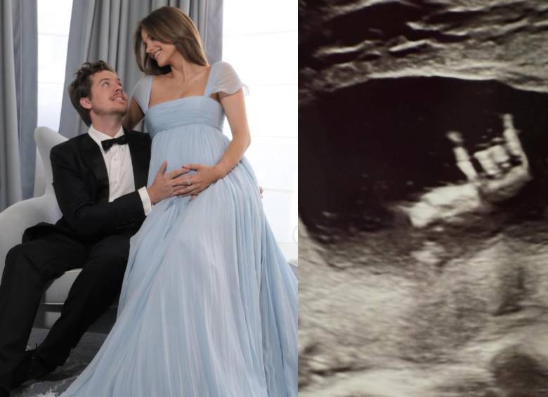 Barbara Palvin y Dylan Sprouse sorprendieron en Cannes 2026 al revelar que se convertirán en padres por primera vez. FOTO: Redes sociales de Barbara Palvin y Dylan Sprouse.