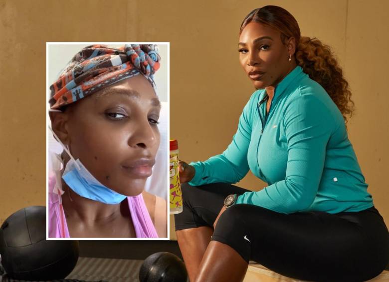 La importante extenista estadounidense contó por medio de un video como fue toda su experiencia tras la operación de un quiste en su cuello y ya se encuentran recuperándose de gran forma. FOTOS: Tomadas de redes sociales de Serena Williams