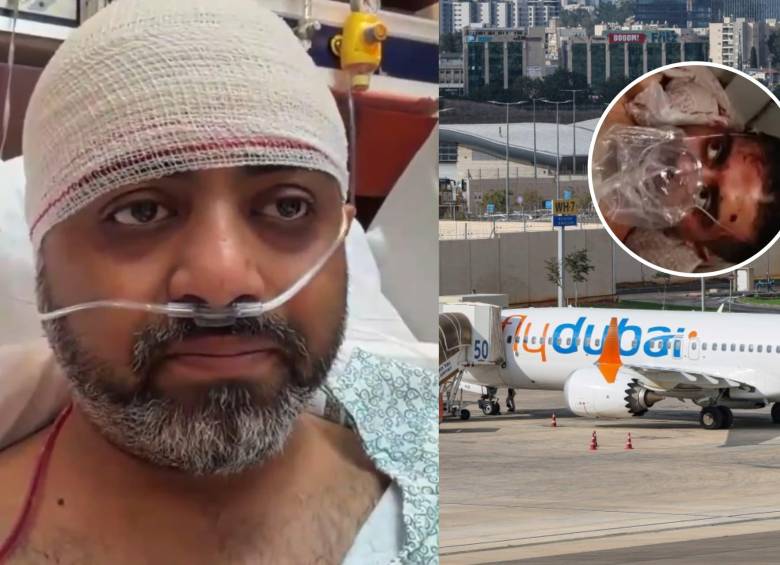 El capitán Smit Machchhar, pese a estar herido, logró abrir la puerta de la cabina para permitir que los pasajeros ingresaran y ayudaran a controlar la emergencia a bordo. Foto: redes sociales @narendramodi/ AFP