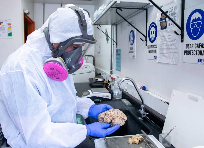 El Grupo de Neurociencias de Antioquia adelanta estudios científicos sobre la “mutación paisa” de alzhéimer. Hay hallazgos importantes publicados en una revista internacional. FOTO: Cortesía
