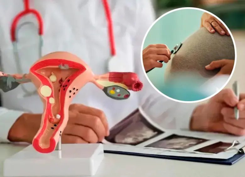 Histórico: por primera vez Corte permite reversar ligadura de trompas en Colombia. Foto: Getty