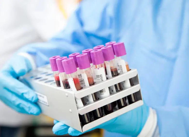 El virus del VIH puede permanecer oculto en focos celulares repartidos por tejidos del organismo incluso cuando los retrovirales lo mantienen bajo control. Foto Agencia Sinc