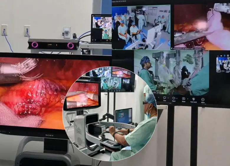 La cirugía a distancia se hizo gracias a un robot y a una conexión satelital de internet además de un apoyo de médicos indios que estaban preparados en caso de alguna falla en la conectividad. Foto: Captura videos redes sociales. 