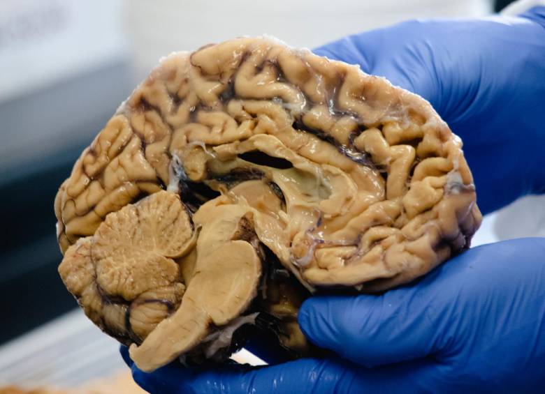 Cerebro en el laboratorio del GNA. FOTO Dirección de Comunicaciones U. de A. / Alejandra Uribe F.