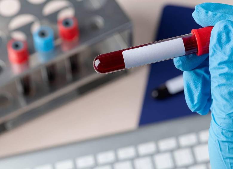 El prototipo de test desarrollado permite detectar en sangre el biomarcador sAXL, asociado al cáncer de páncreas, mediante una tira reactiva de bajo coste. FOTO Agencia Sinc