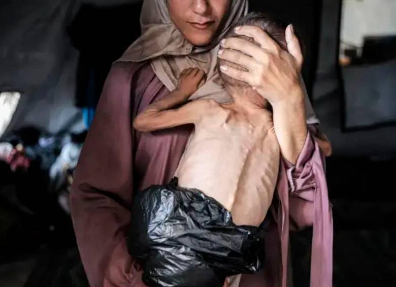 La Organización Mundial de la Salud afirma que 148 personas murieron de desnutrición en Gaza desde enero de 2025. FOTO: Ahmed al-Arini, Getty