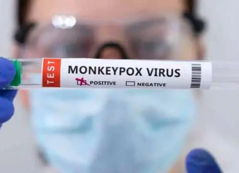 La Organización Mundial de la Salud (OMS) ha contabilizado 34.386 infecciones por mpox hasta ahora. FOTO: AFP