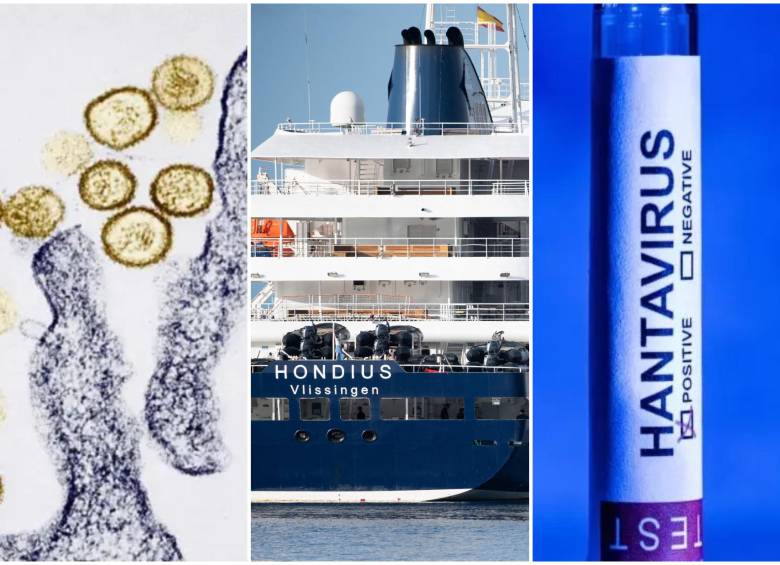 Tras el trágico saldo de tres muertes a bordo del crucero Hondius, el Ministerio de Sanidad español ha confirmado un nuevo caso positivo en Madrid. FOTO: AFP
