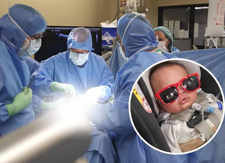 Cassian, fue diagnosticado dentro del vientre de su madre con una condición llamada CHAOS que ponía en riesgo su vida. Después de la cirugía, Cassian esperó 6 semanas para “volver a nacer”. Foto: Orlando Health Winnie Palmer Hospita