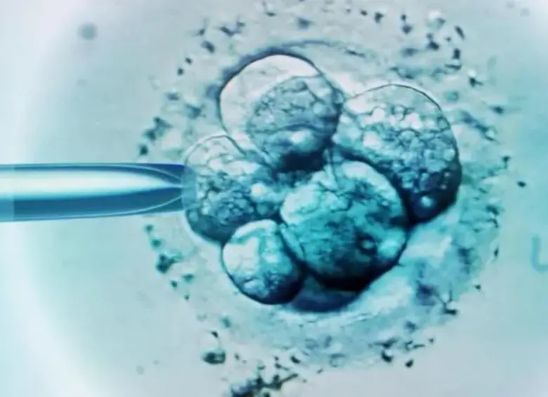 El método, desarrollado por científicos británicos, combina el óvulo y el esperma de la madre y el padre con un segundo óvulo de una mujer donante. FOTO: Getty