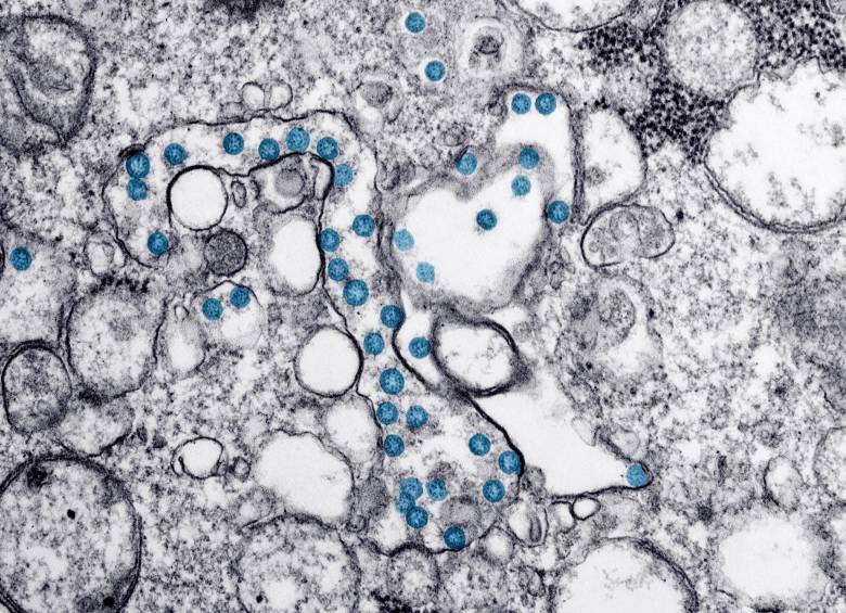 Partículas del virus SARS-CoV-2, coloreadas en azul, en una imagen de microscopio de electrones. FOTO csic.es