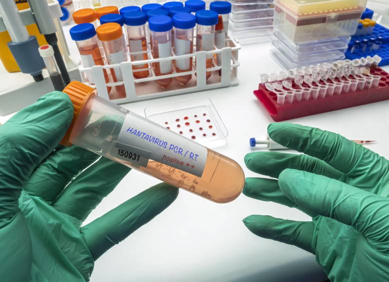 El Centro Médico de la Universidad de Nebraska validó en 48 horas la única prueba PCR disponible en EE. UU. para detectar el virus de los Andes en fases tempranas. FOTO Science Photo Library via AFP