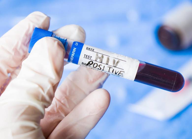 En el país alrededor de 180.000 personas viven con este diagnóstico. FOTO: SSTOCK